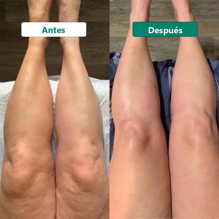 Resultado antes/después