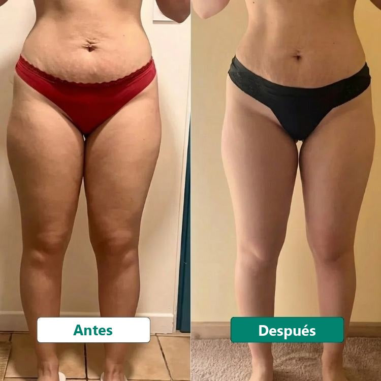 Resultado antes/después