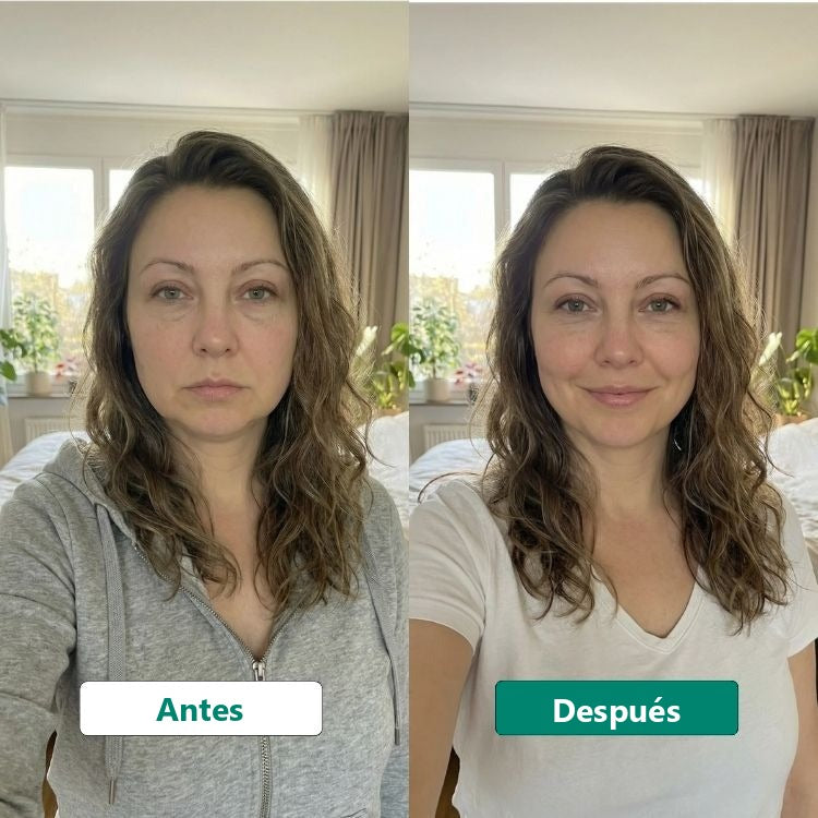 Resultado antes/después